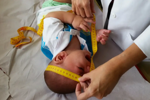 INSS pagará indenização de R$ 60 mil a crianças vítimas de zika vírus