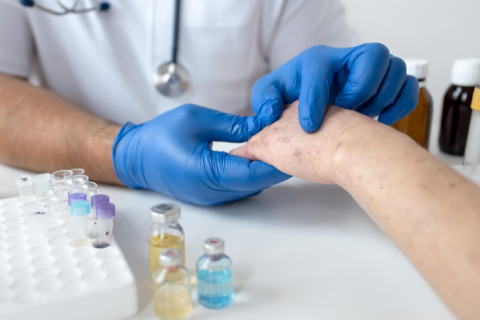 Herpes Zoster: tratamento correto é essencial para impedir o surgimento de complicações